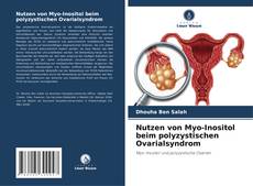 Bookcover of Nutzen von Myo-Inositol beim polyzystischen Ovarialsyndrom