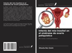 Обложка Interés del mio-inositol en el síndrome de ovario poliquístico