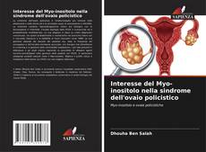Buchcover von Interesse del Myo-inositolo nella sindrome dell'ovaio policistico