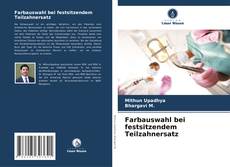 Bookcover of Farbauswahl bei festsitzendem Teilzahnersatz