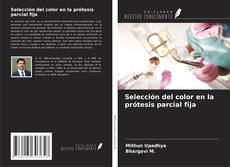 Buchcover von Selección del color en la prótesis parcial fija