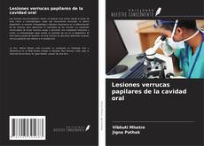 Capa do livro de Lesiones verrucas papilares de la cavidad oral 