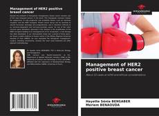 Capa do livro de Management of HER2 positive breast cancer 