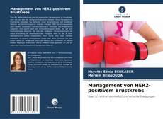 Copertina di Management von HER2-positivem Brustkrebs