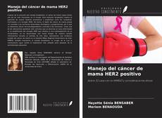 Portada del libro de Manejo del cáncer de mama HER2 positivo