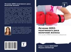 Buchcover von Лечение HER2-позитивного рака молочной железы