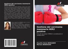 Gestione del carcinoma mammario HER2 positivo kitap kapağı