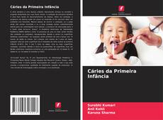 Borítókép a  Cáries da Primeira Infância - hoz
