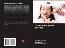 Bookcover of Caries de la petite enfance