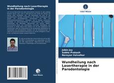 Wundheilung nach Lasertherapie in der Parodontologie kitap kapağı