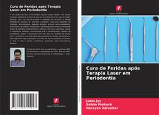 Capa do livro de Cura de Feridas após Terapia Laser em Periodontia 