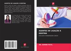 Capa do livro de AGENTES DE LIGAÇÃO À DENTINA 