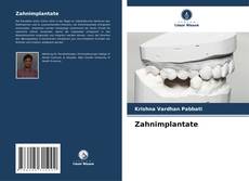 Обложка Zahnimplantate