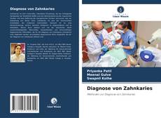 Diagnose von Zahnkaries kitap kapağı