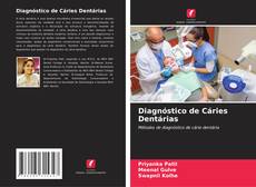 Copertina di Diagnóstico de Cáries Dentárias