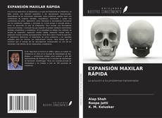 EXPANSIÓN MAXILAR RÁPIDA kitap kapağı
