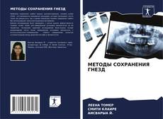 Copertina di МЕТОДЫ СОХРАНЕНИЯ ГНЕЗД