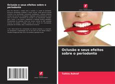 Portada del libro de Oclusão e seus efeitos sobre o periodonto