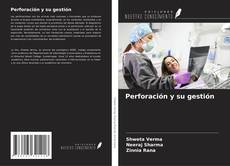 Bookcover of Perforación y su gestión