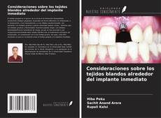Couverture de Consideraciones sobre los tejidos blandos alrededor del implante inmediato
