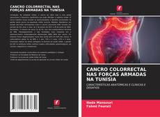 Buchcover von CANCRO COLORRECTAL NAS FORÇAS ARMADAS NA TUNÍSIA