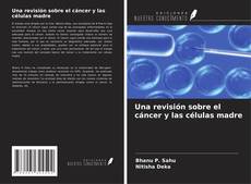 Bookcover of Una revisión sobre el cáncer y las células madre