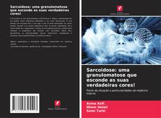 Обложка Sarcoidose: uma granulomatose que esconde as suas verdadeiras cores!