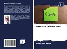 Bookcover of Раковые заболевания