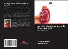 Bookcover of L'artère rénale au-delà du CT et de l'IRM