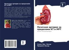 Bookcover of Почечная артерия за пределами КТ и МРТ