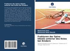 Buchcover von Frakturen der Spina tibialis anterior des Knies bei Kindern