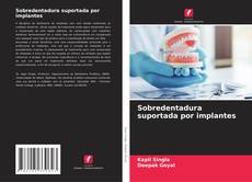 Buchcover von Sobredentadura suportada por implantes