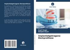 Implantatgetragene Deckprothese kitap kapağı
