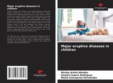Couverture de Major eruptive diseases in children