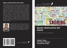 Buchcover von Apnea obstructiva del sueño