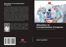 Bookcover of Allocation et transplantation d'organes