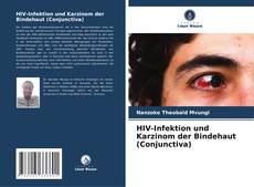 Обложка HIV-Infektion und Karzinom der Bindehaut (Conjunctiva)