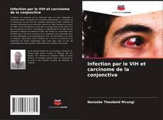 Обложка Infection par le VIH et carcinome de la conjonctive