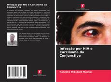 Обложка Infecção por HIV e Carcinoma da Conjunctiva