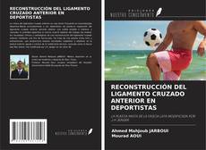 Bookcover of RECONSTRUCCIÓN DEL LIGAMENTO CRUZADO ANTERIOR EN DEPORTISTAS