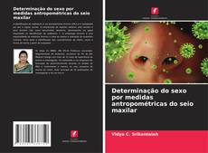 Couverture de Determinação do sexo por medidas antropométricas do seio maxilar