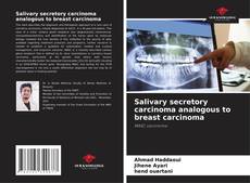 Bookcover of Salivary secretory carcinoma analogous to breast carcinoma