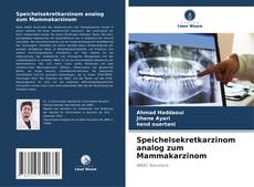 Bookcover of Speichelsekretkarzinom analog zum Mammakarzinom