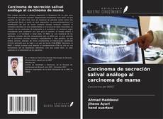 Bookcover of Carcinoma de secreción salival análogo al carcinoma de mama