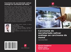 Bookcover of Carcinoma do secretariado salivar análogo ao carcinoma da mama