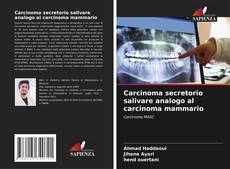 Bookcover of Carcinoma secretorio salivare analogo al carcinoma mammario