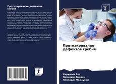 Buchcover von Протезирование дефектов гребня