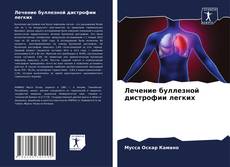 Buchcover von Лечение буллезной дистрофии легких