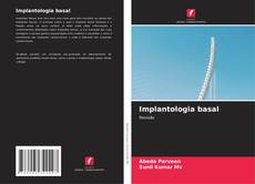 Couverture de Implantologia basal