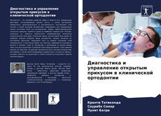 Buchcover von Диагностика и управление открытым прикусом в клинической ортодонтии